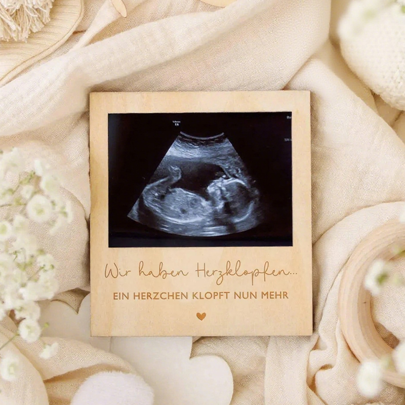 Ultrasound Pregnancy Announcem – обзор и цена Photo Booth Frame