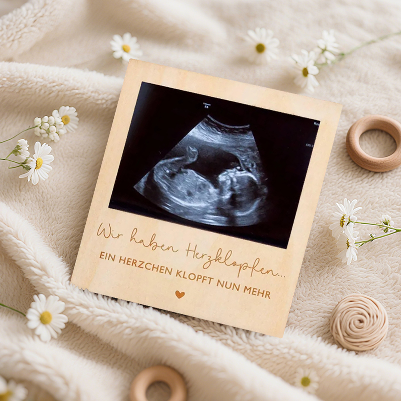 Ultrasound Pregnancy Announcem – обзор и цена Photo Booth Frame