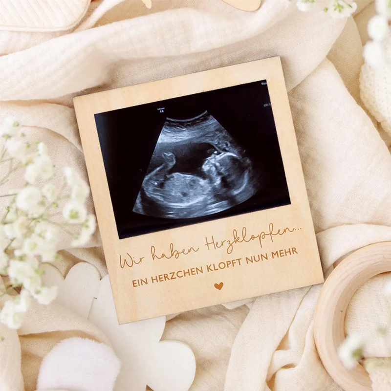 Ultrasound Pregnancy Announcem – обзор и цена Photo Booth Frame